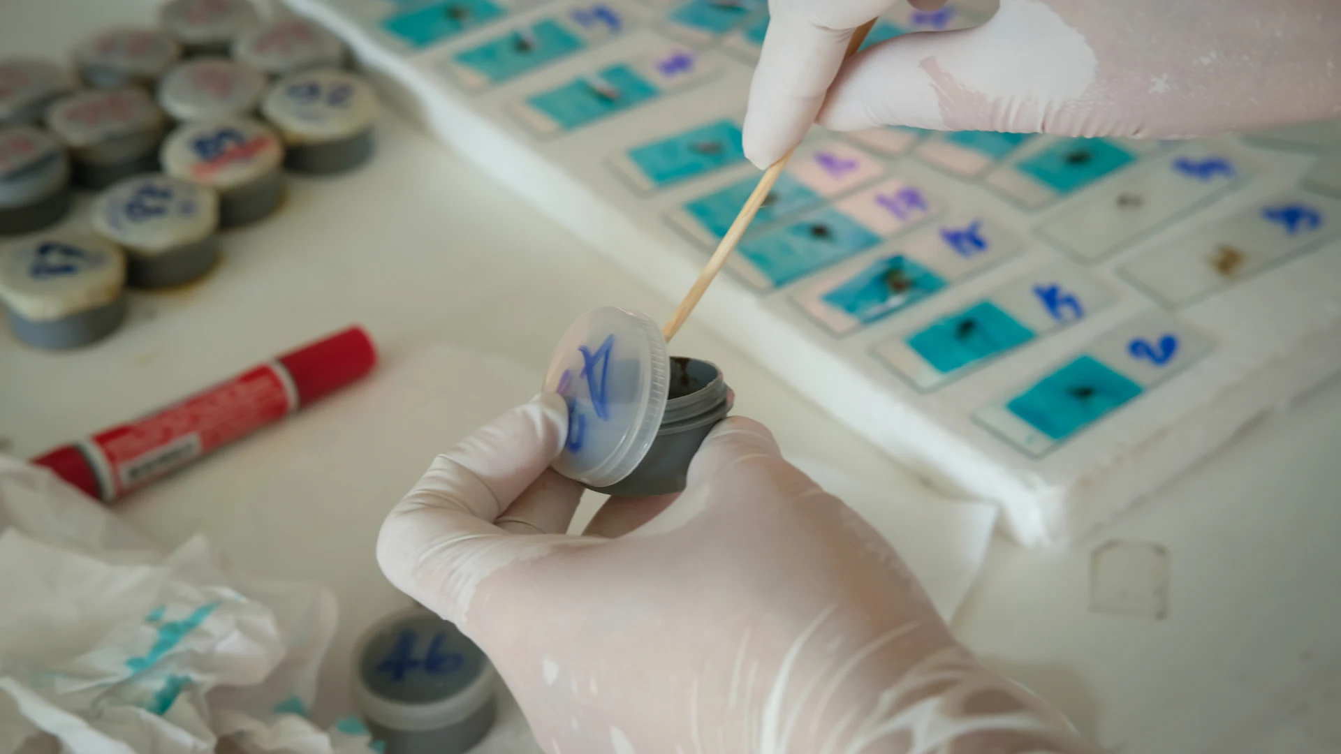 Stool Culture Test